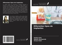 Diferentes Tipos De Implantes Ankita Kale
