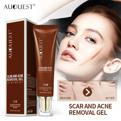 AUQUEST Scar Repair Cream Stretch Marks Acne Remove Promote Cell Regeneration...