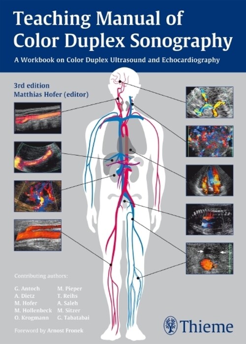 Thumbnail - Teaching Manual Of Color Duplex Sonography Matthias Hofer Taschenbuch