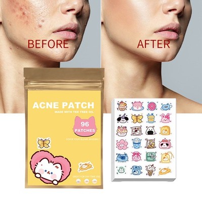 96pcs Acne Patches Cat Shaped Acne Treatment Sticker Invisible Acne Cover
