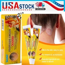 Health Care Psoriasis Cream Eczema Ointment Scalp Psoriasis Hand Tinea Foot 20g