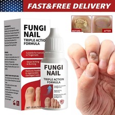 Fungi-Nail Anti-Fungal Liquid Solution Kills Fungus That Can Lead To Nail