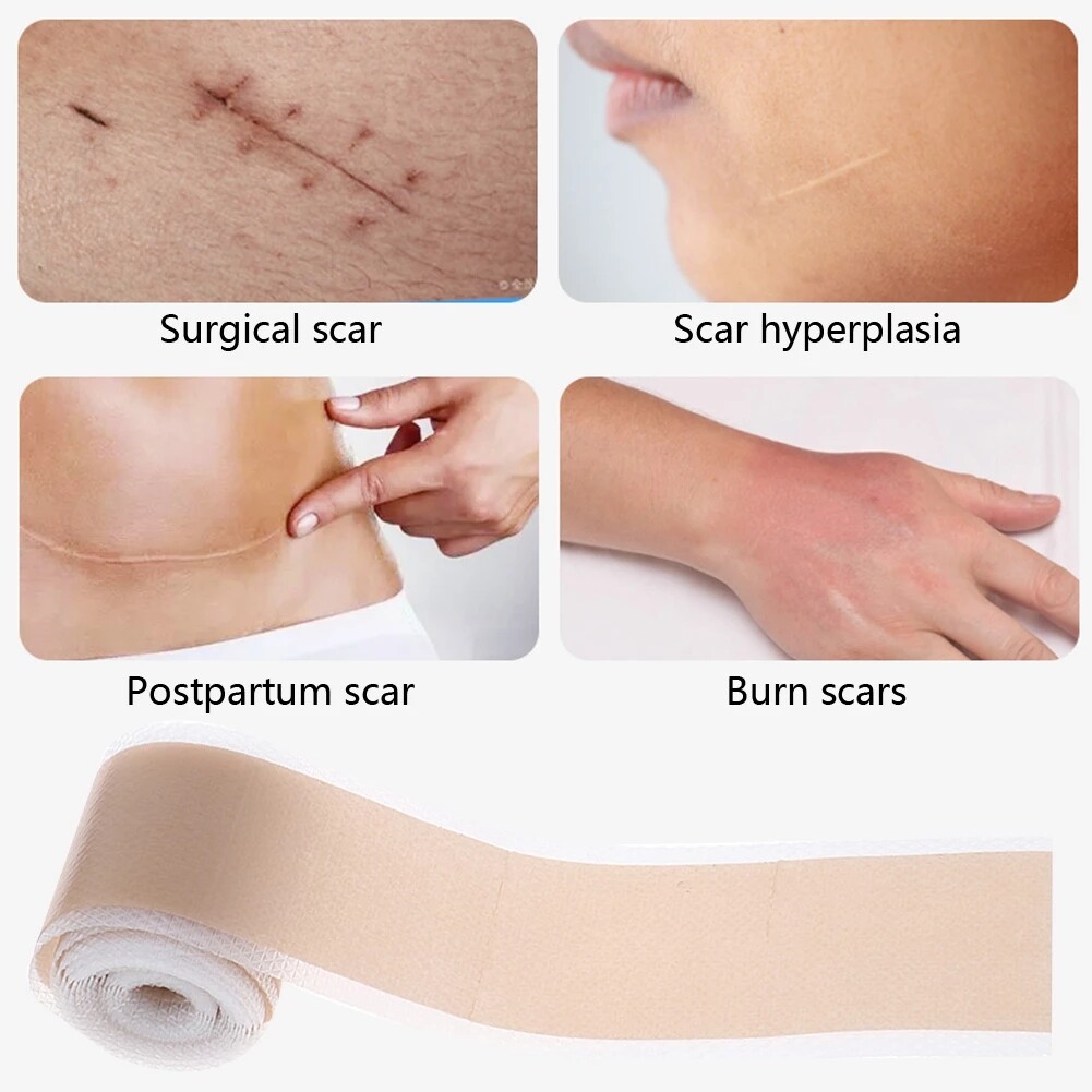 Scar Removal Silicone Gel Tape Efficient Surgery Scar Removal Bandage
