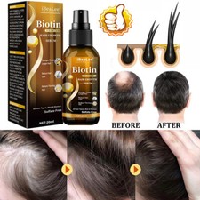 Biotin Hair Growth Spray Anti Hair Loss Fast Regrowth Scalp Treatment Serum US