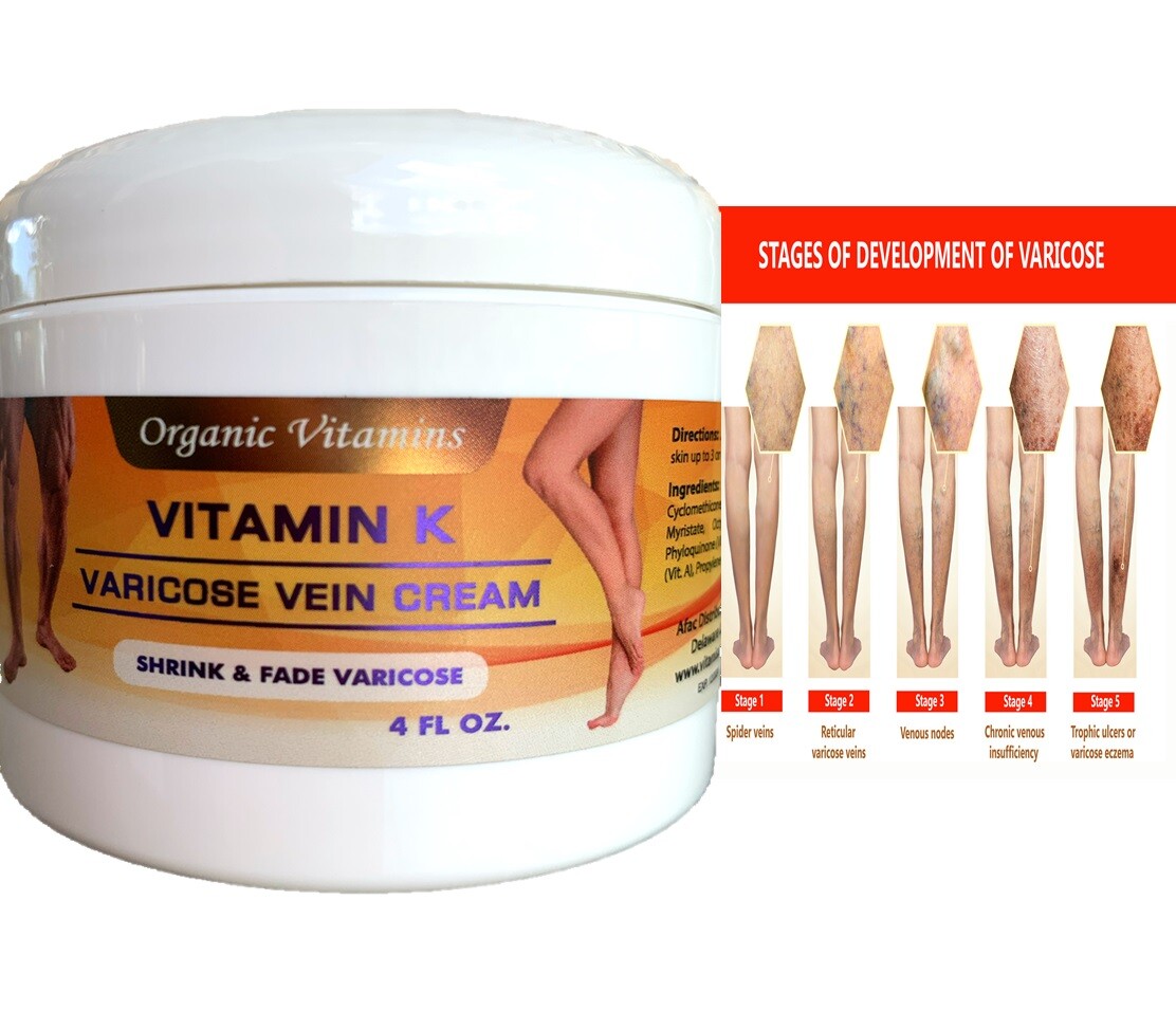 Vein Varicose Veins Support Cream Spider Leg Massage crema