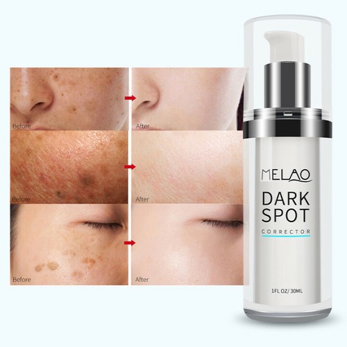 Skin Whitening Brightening For Face 30ml