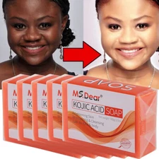 5/3X Kojic Acid Soap Acne Dark Spot Remover Skin Lightening Whitening Face Body