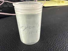 My First Baby Tooth 11-17-93