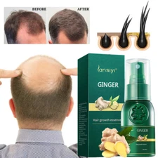 5/3xNatural Herbal Hair Growth Essence Spray Anti Hair Loss Fast Grow Serum 30ML