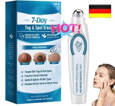 Picdo Stielwarzen-Entferner,Entferner für St...