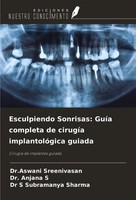 Esculpiendo Sonrisas: GuíA Completa De CirugíA ImplantolóGica Guiada Taschenbuch