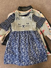 Lot Of 5 Girls Dresses/ Gap, Esprit, Carters. 3 Years
