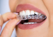 Custom Made Dental Retainers Upper   AND Lower Full Set - USA Dental Lab.