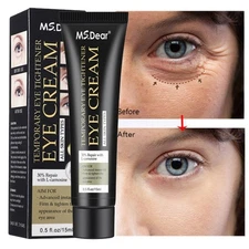 Under Eye Cream Remove Dark Circles Bags Face Lines Ageless Wrinkles Puffy Eye~