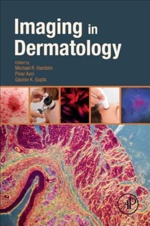 Imaging in Dermatology Hamblin Avci Gupta Paperback Academic Press 9780128028384
