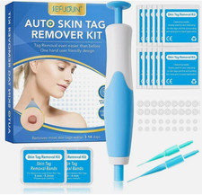 Auto Micro Skin Tag Remover Device Kit Safe Painless Removal 2-8 mm Band Tool