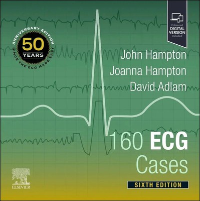 160 ECG Cases | John Hampton (u. a.) | Taschenbuch | Englisch | 2024