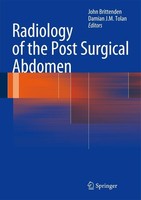 Radiology Of The Post Surgical Abdomen John Brittenden