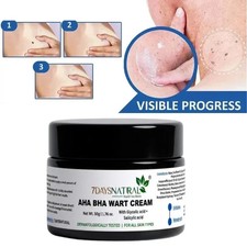 7 Days Genital Wart Removal Cream for Men Women 50 GM