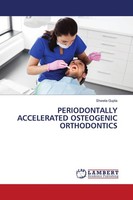 Periodontally Accelerated Osteogenic Orthodontics Shweta Gupta
