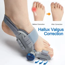 New Hallux Valgus Correction Foot Corrector Bunion Splint Big Toe Straightener 