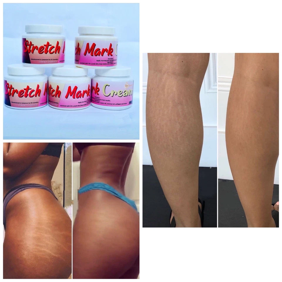 stretch mark cream - Image 2 of 4
