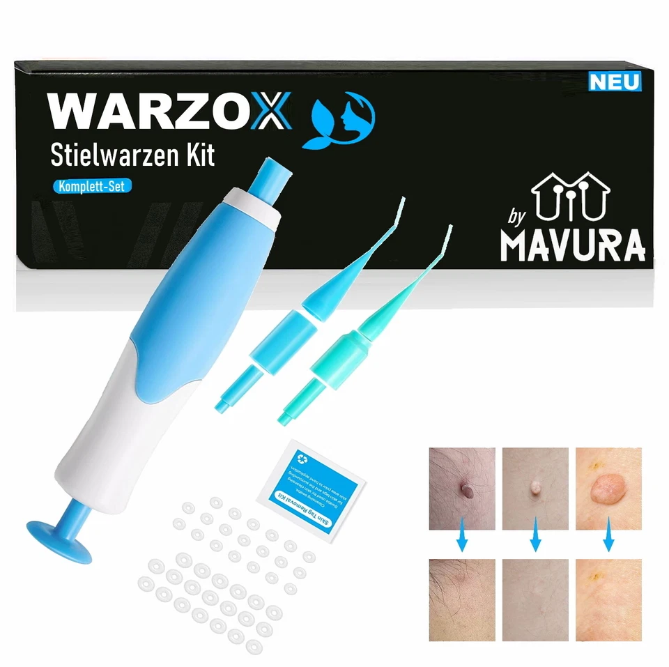 WARZOX skin tag remover kit stem warts set fibroma cosmetic remover 54pcs