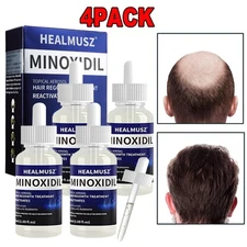 4 Pack Minoxidil 5% Extra Strength Men 4 Month Supply Hair Regrowth Solution