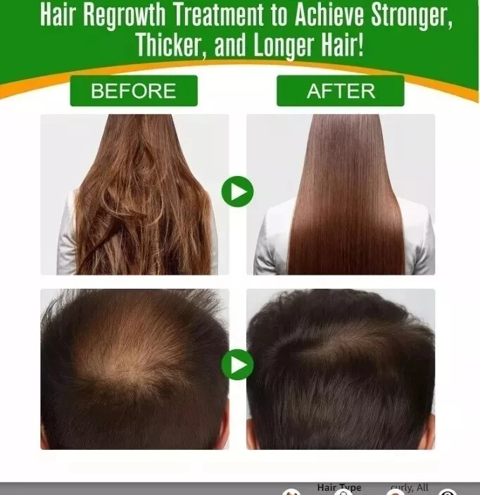 Batana Oil Shampoo for Hair Growth, 100% Organic & Pure, Dr Sebi Approved, 100ml - Image 3 of 4