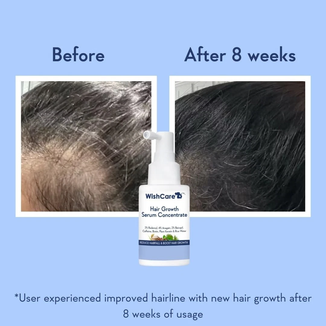 WishCare Hair Growth Serum 3% Redensyl 4% Anagain 2% Baicapil Biotin Caffeine