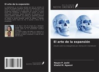 El Arte De La ExpansióN Nayan P. Joshi