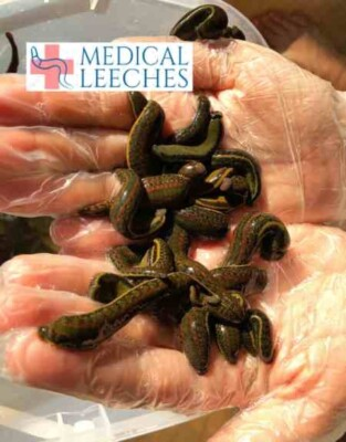 #ad 10 Live Leeches for Hirudotherapy quot;Hirudo Verbana Medical Leeches” All Sizes $199.00