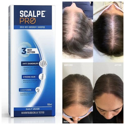 Scalpe Pro Anti-Dandruff Shampoo 100Ml reduces hair fall due to breakage