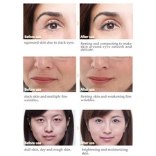 artiscare peptide anti wrinkle