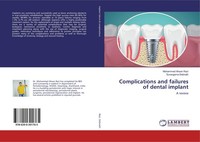 Complications And Failures Of Dental Implant Surangama Debnath