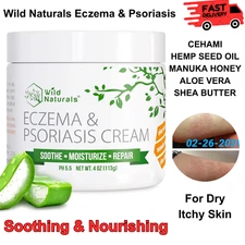 Wild Naturals Eczema & Psoriasis Cream – Itch Relief with Manuka Honey, 4 oz