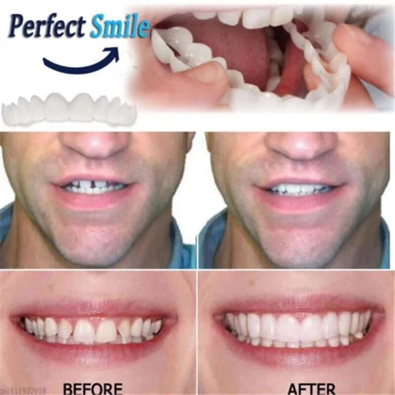 Magical teeth brace deals