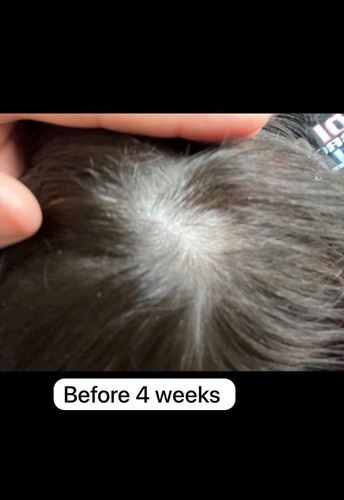 Weleda Revitalising Hair Tonic with Rosemary Oil to Promote Hair Growth - Picture 4 of 5