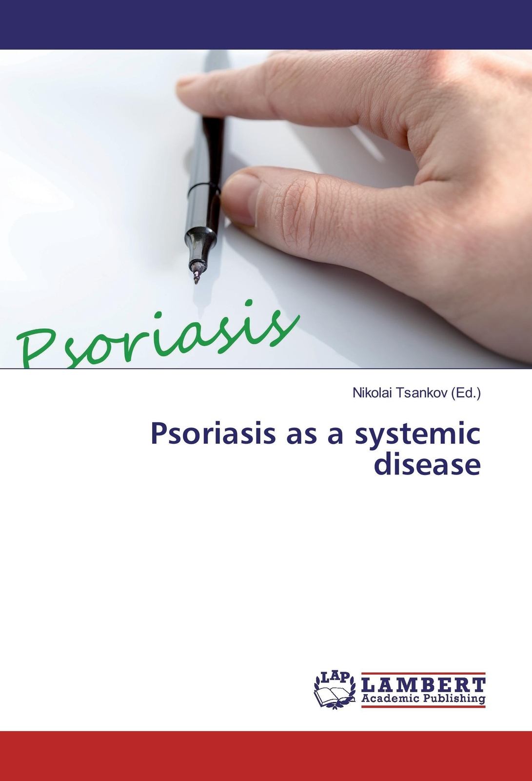 Nikolai Tsankov | Psoriasis As A Systemic Disease | Taschenbuch |