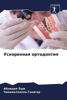 Abhishek Joshi (U. A.) | Uskorennaq Ortodontiq | Taschenbuch | Russisch (2023)