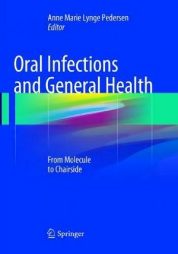 Thumbnail - Oral Infections And General Health From Molecule To Chairside 5491