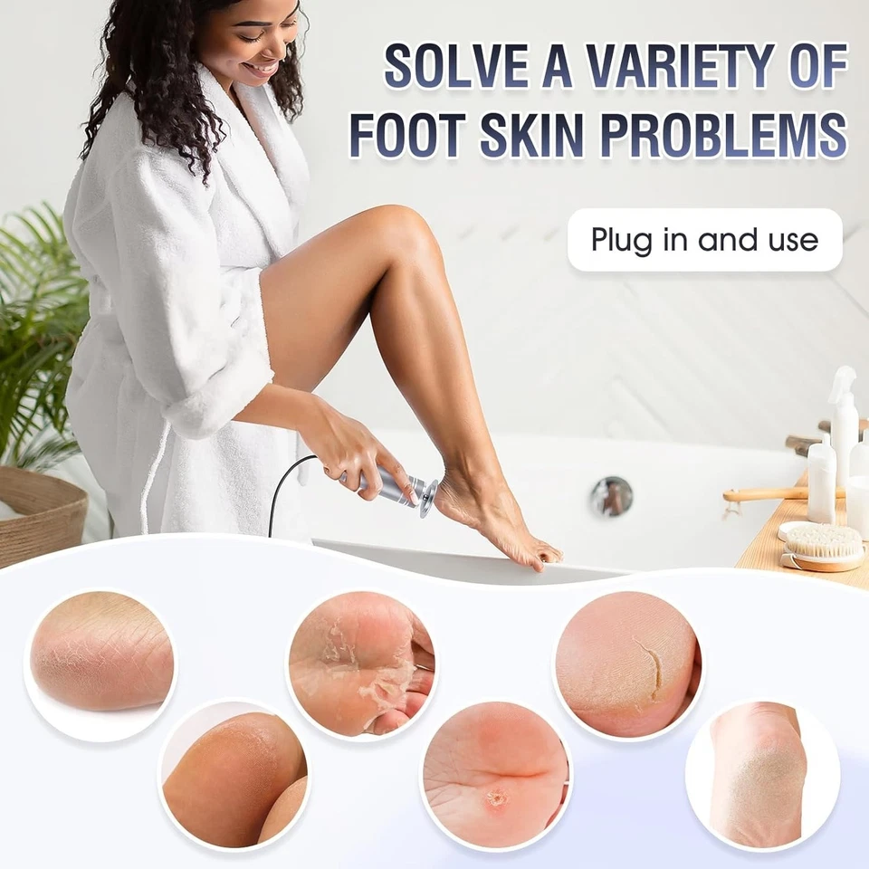 Rotating Pedicure Tool for Dead Skin, Cracked Heels –Smooth Soft Feet Exfoliator - Image 4 of 4