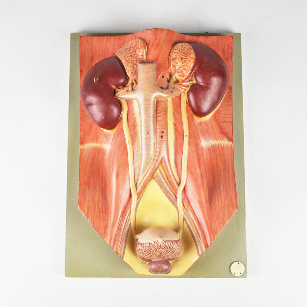Bladder Model Labeled