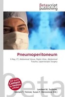Lambert M. Surhone (U. A.) | Pneumoperitoneum | Taschenbuch | Englisch (2026)