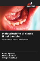 Naina Agarwal (U. A.) | Malocclusione Di Classe II Nei Bambini | Taschenbuch
