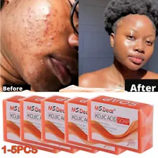 5/3x Kojic Acid Soap Dark Spot Whitening Bleaching Lightening Face & Body Skin