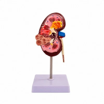 Modèle D'anatomie du Rein Anatomique Modèle de Rein Médical pour Enseignants - Photo 1/4