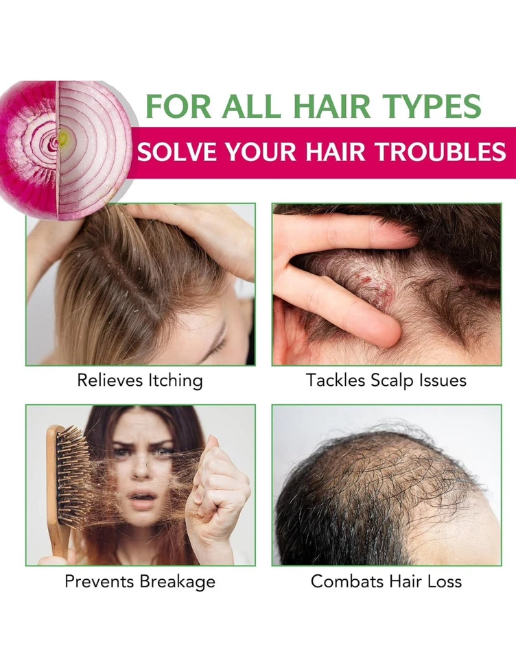 Onion Biotin and Rosemary Shampoo Set for Thinning Hair, Growth, and Shine 500ML - Image 4 of 4