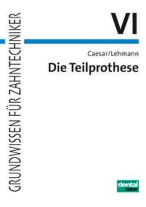 Thumbnail - Die Teilprothese, Hans H. Caesar