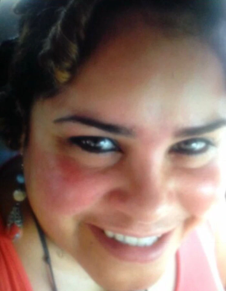 Sammy Skincare Dark Spots Remover Cream Extra Strength, 2oz Per Unit. - Image 3 of 4